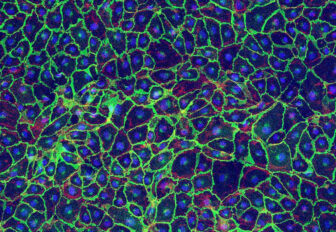 Vascular endothelial cells