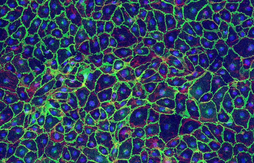 Vascular endothelial cells