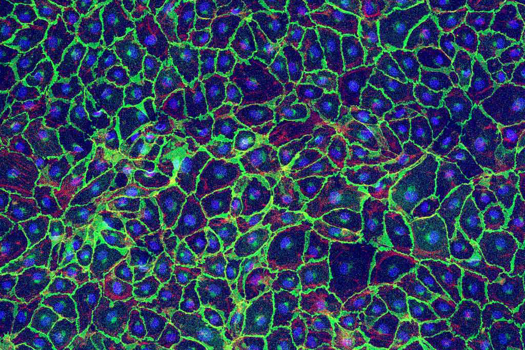 Vascular endothelial cells