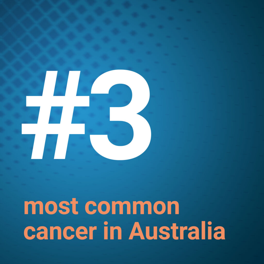 Melanoma - 3rd most common cancer