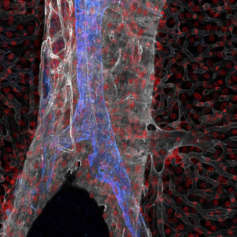 Rare Diseases & Gene Therapy | Centenary Institute